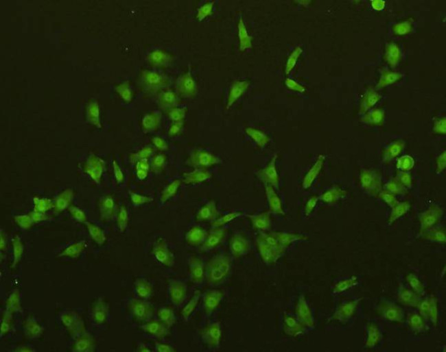 Caspase 3 Antibody in Immunocytochemistry (ICC/IF)