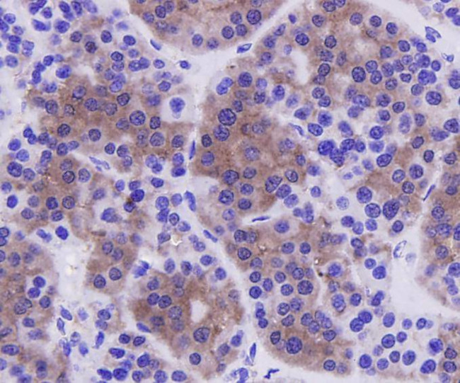 Caspase 3 Antibody in Immunohistochemistry (Paraffin) (IHC (P))