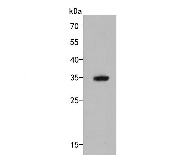 MTHFD2 Antibody in Western Blot (WB)