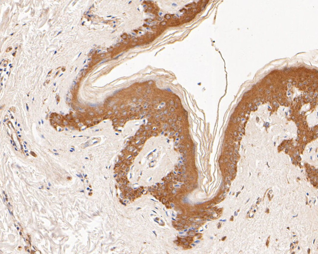 GADD34 Antibody in Immunohistochemistry (Paraffin) (IHC (P))