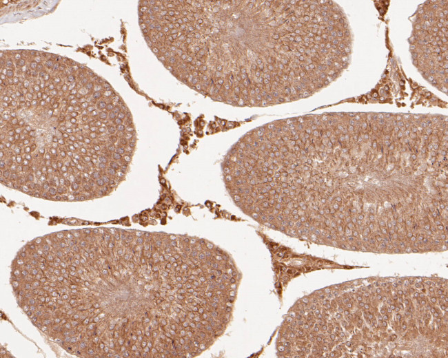 Connexin 26 Antibody in Immunohistochemistry (Paraffin) (IHC (P))