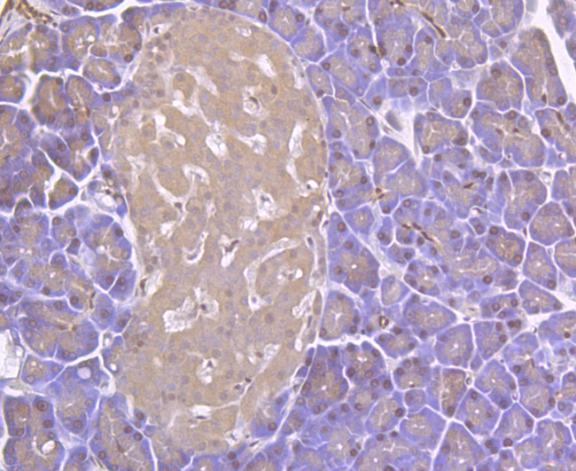 RIP3 Antibody in Immunohistochemistry (Paraffin) (IHC (P))