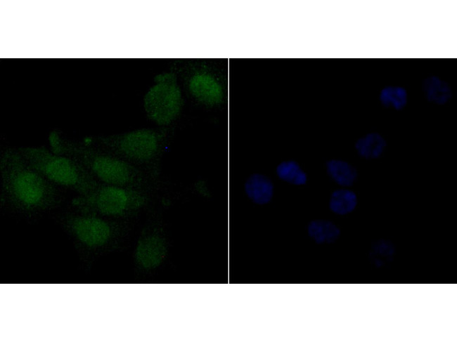 delta Catenin Antibody in Immunocytochemistry (ICC/IF)