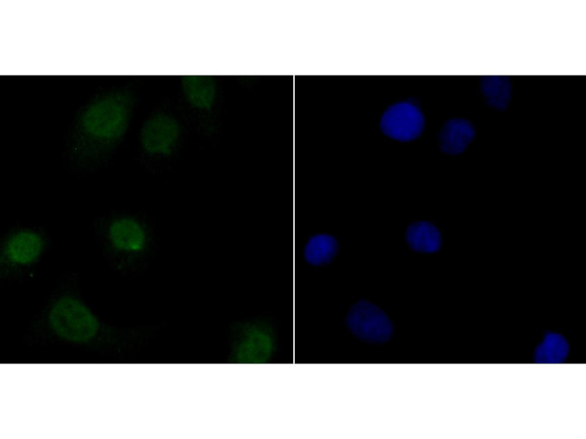 delta Catenin Antibody in Immunocytochemistry (ICC/IF)