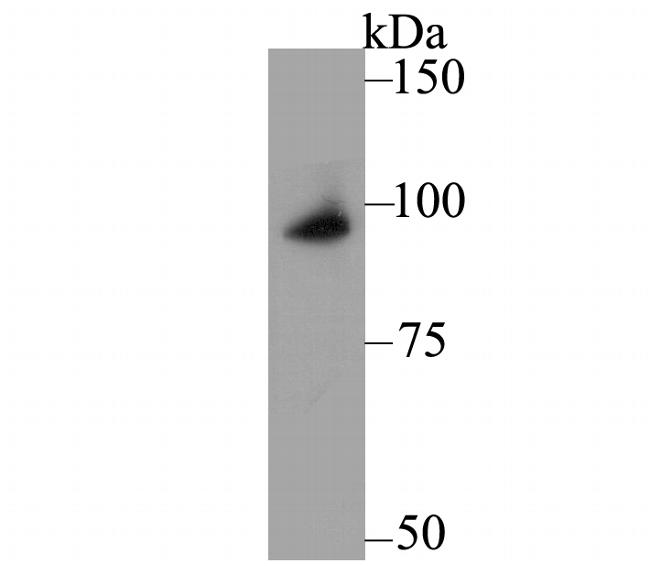 delta Catenin Antibody in Western Blot (WB)