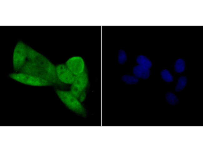 p16INK4a Antibody in Immunocytochemistry (ICC/IF)