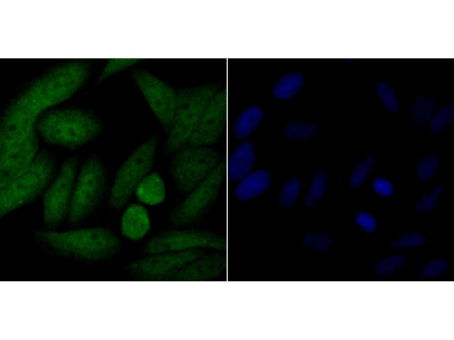 p16INK4a Antibody in Immunocytochemistry (ICC/IF)