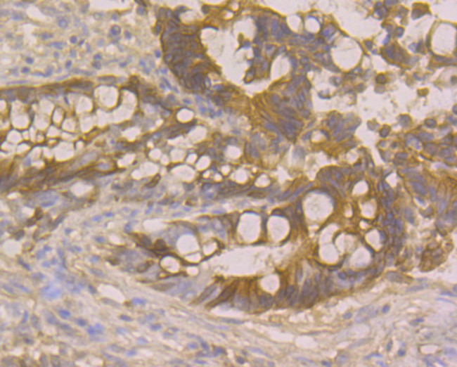 p16INK4a Antibody in Immunohistochemistry (Paraffin) (IHC (P))