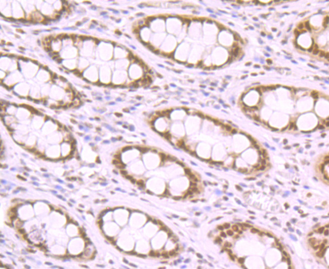 Histone Macro-H2A.1 Antibody in Immunohistochemistry (Paraffin) (IHC (P))