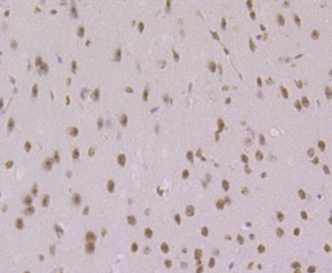 Histone Macro-H2A.1 Antibody in Immunohistochemistry (Paraffin) (IHC (P))