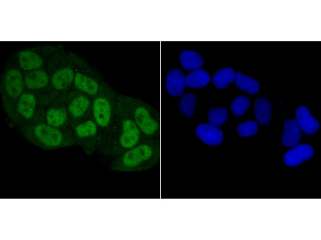 BUBR1 Antibody in Immunocytochemistry (ICC/IF)