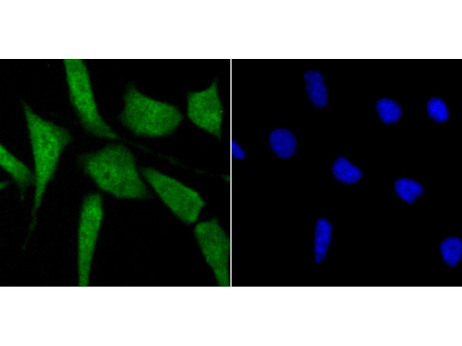 BUBR1 Antibody in Immunocytochemistry (ICC/IF)