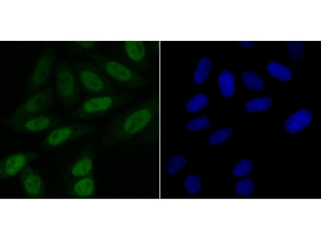 BUBR1 Antibody in Immunocytochemistry (ICC/IF)