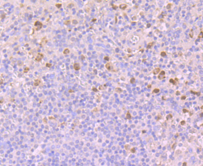 BUBR1 Antibody in Immunohistochemistry (Paraffin) (IHC (P))