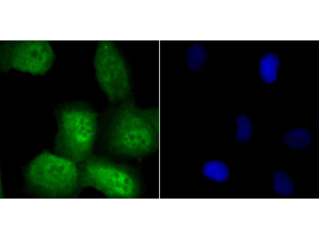 Securin Antibody in Immunocytochemistry (ICC/IF)