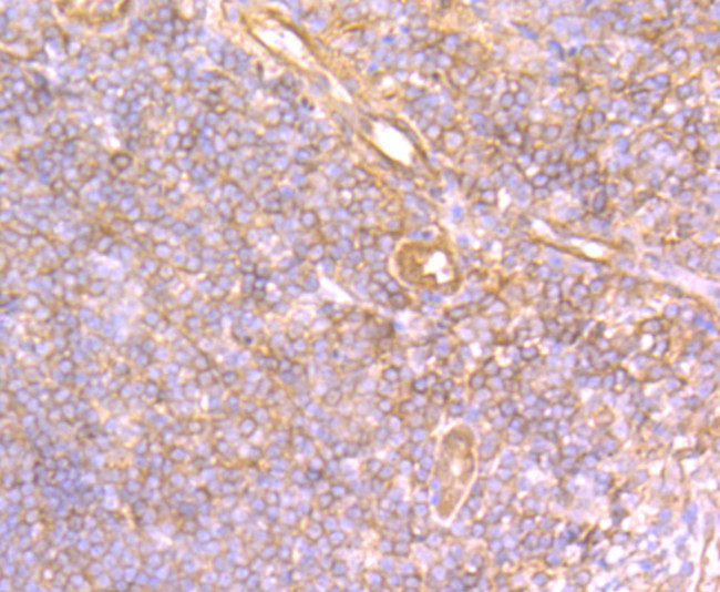 Securin Antibody in Immunohistochemistry (Paraffin) (IHC (P))