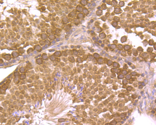 Securin Antibody in Immunohistochemistry (Paraffin) (IHC (P))