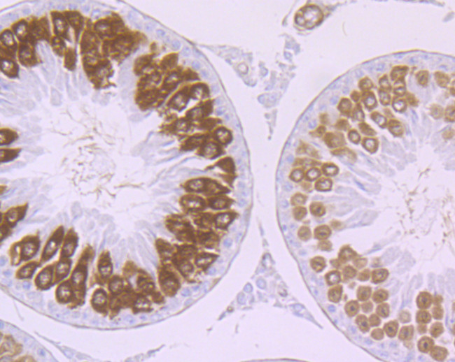 Securin Antibody in Immunohistochemistry (Paraffin) (IHC (P))