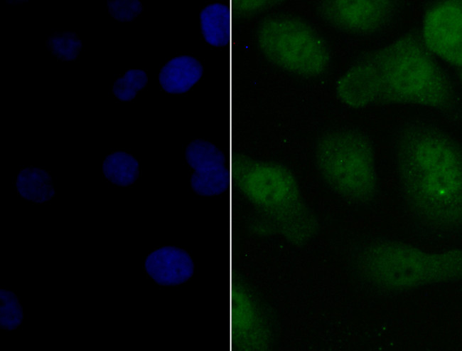 PAX8 Antibody in Immunocytochemistry (ICC/IF)