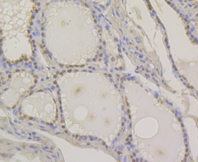 PAX8 Antibody in Immunohistochemistry (Paraffin) (IHC (P))