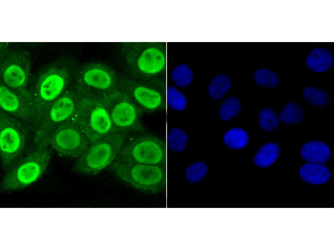 APE1 Antibody in Immunocytochemistry (ICC/IF)