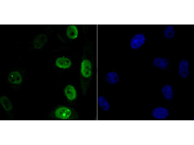 APE1 Antibody in Immunocytochemistry (ICC/IF)