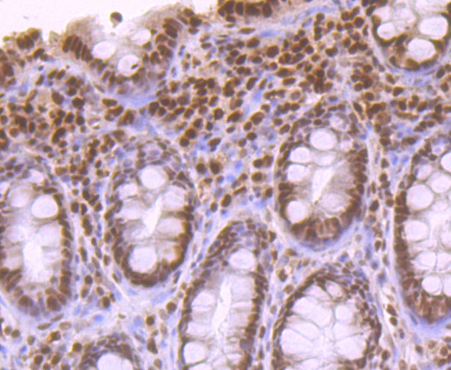 APE1 Antibody in Immunohistochemistry (Paraffin) (IHC (P))