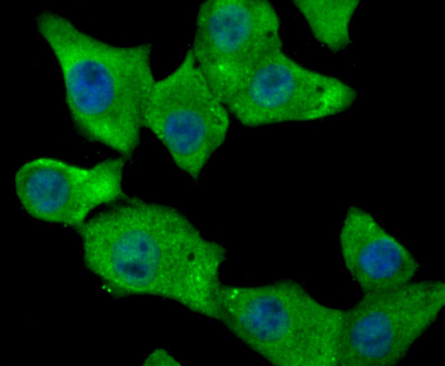 Fibrinogen Antibody in Immunocytochemistry (ICC/IF)