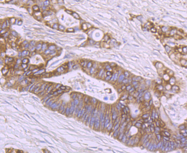 SHP2 Antibody in Immunohistochemistry (Paraffin) (IHC (P))