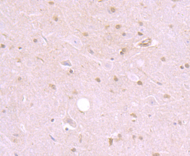 SHP2 Antibody in Immunohistochemistry (Paraffin) (IHC (P))