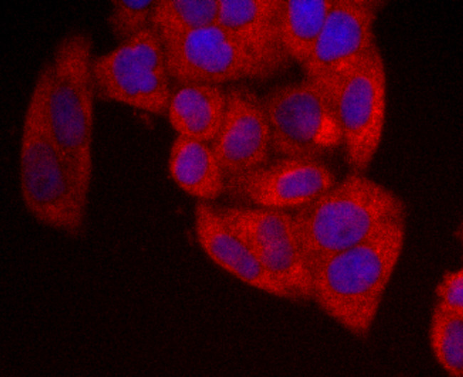 NME1 Antibody in Immunocytochemistry (ICC/IF)