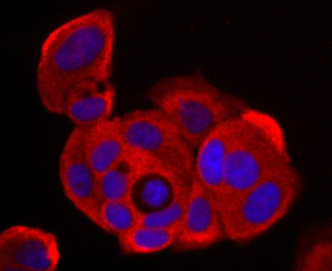 NME1 Antibody in Immunocytochemistry (ICC/IF)