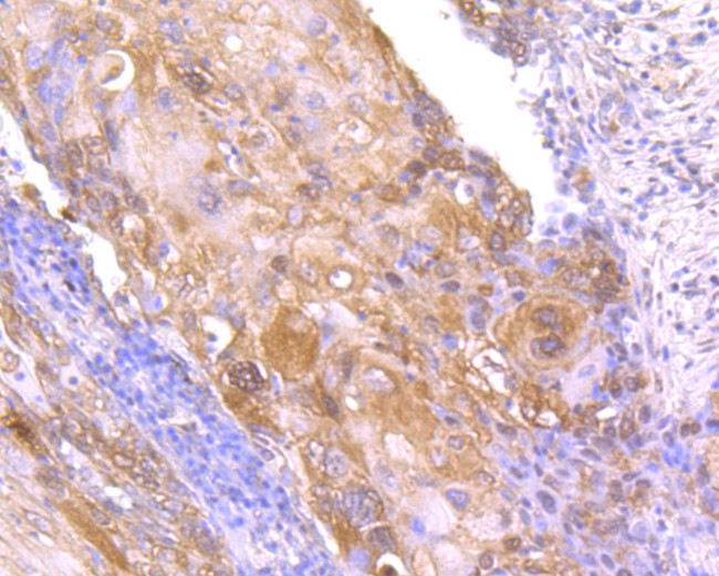 NME1 Antibody in Immunohistochemistry (Paraffin) (IHC (P))