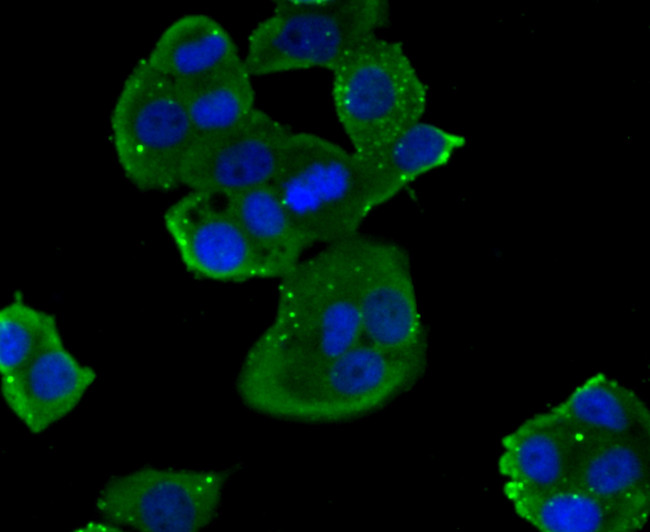 NOX2 Antibody in Immunocytochemistry (ICC/IF)