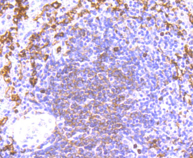 NOX2 Antibody in Immunohistochemistry (Paraffin) (IHC (P))