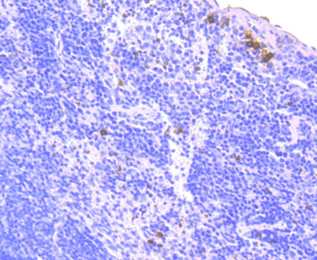 NOX2 Antibody in Immunohistochemistry (Paraffin) (IHC (P))