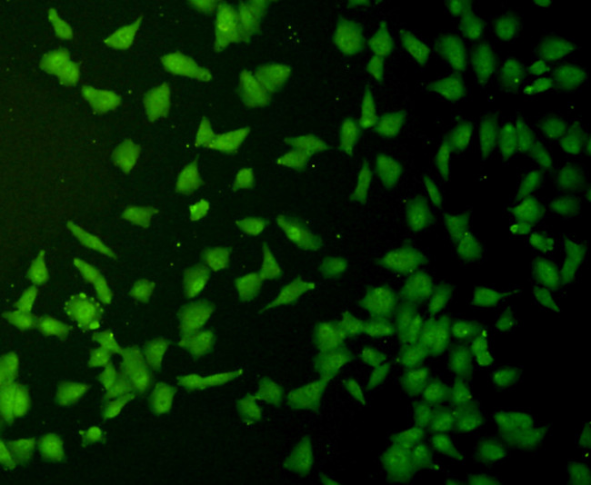 Cyclin D1 Antibody in Immunocytochemistry (ICC/IF)