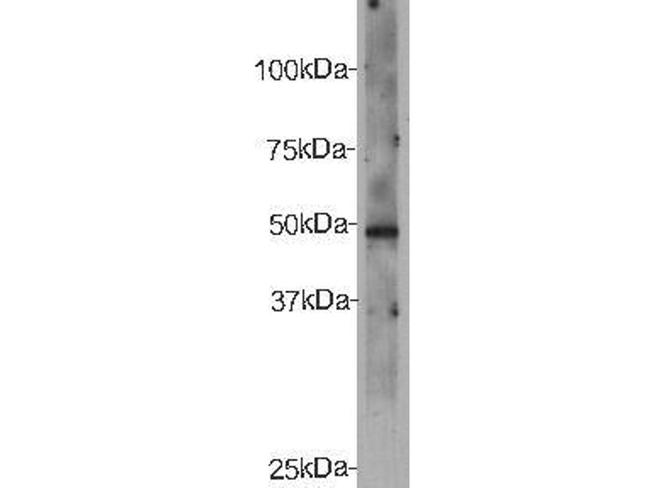 CELSR2 Antibody in Western Blot (WB)