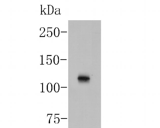TMEM67 Antibody in Western Blot (WB)