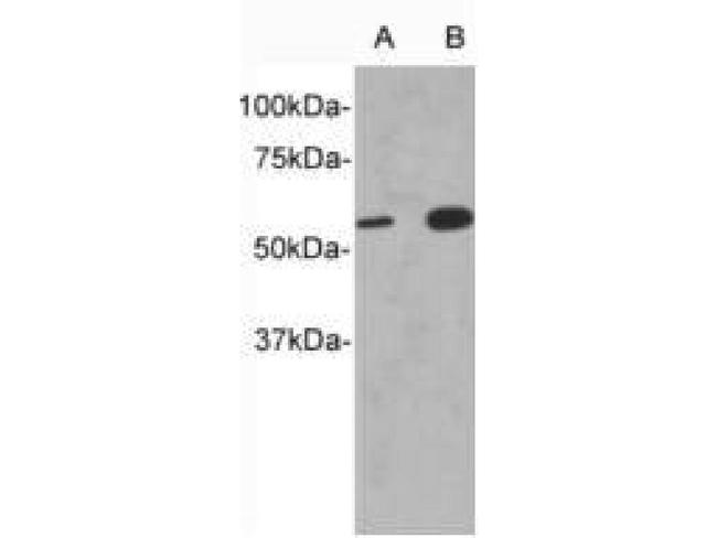 IL13RA1 Antibody in Western Blot (WB)