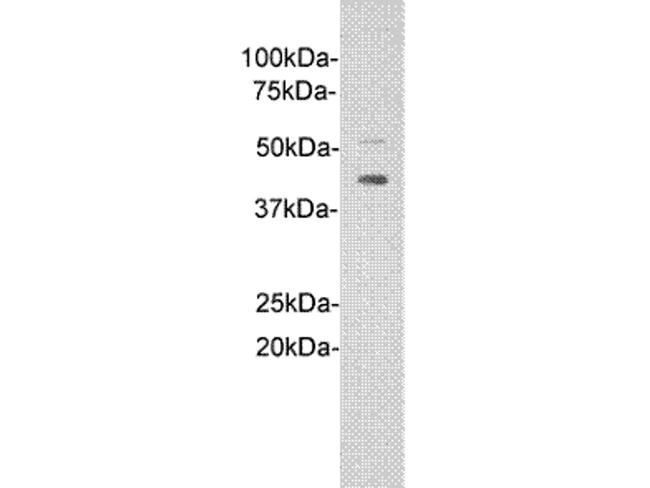 ST2 Antibody in Western Blot (WB)