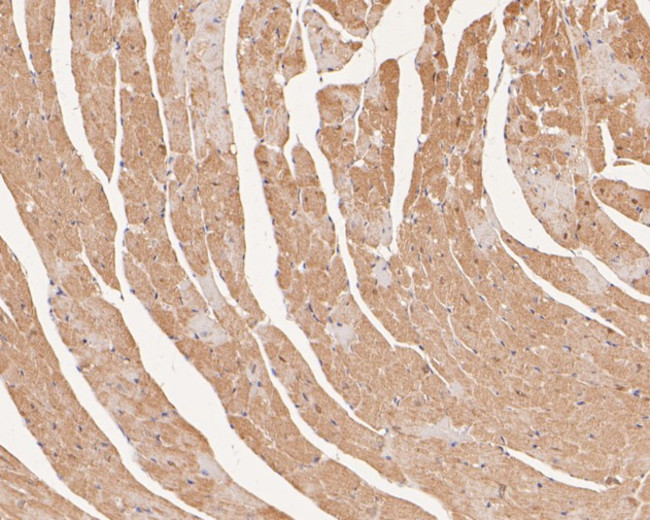 Ly-6G Antibody in Immunohistochemistry (Paraffin) (IHC (P))