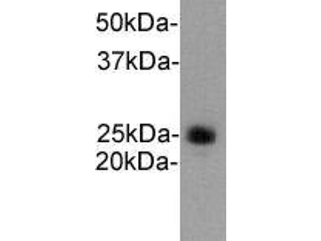 Ly-6G Antibody in Western Blot (WB)