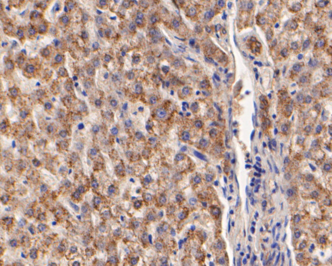 ARF1 Antibody in Immunohistochemistry (Paraffin) (IHC (P))