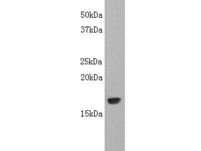 LTA Antibody in Western Blot (WB)