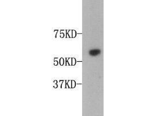 Osteopontin Antibody in Western Blot (WB)