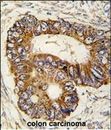 REA Antibody in Immunohistochemistry (Paraffin) (IHC (P))