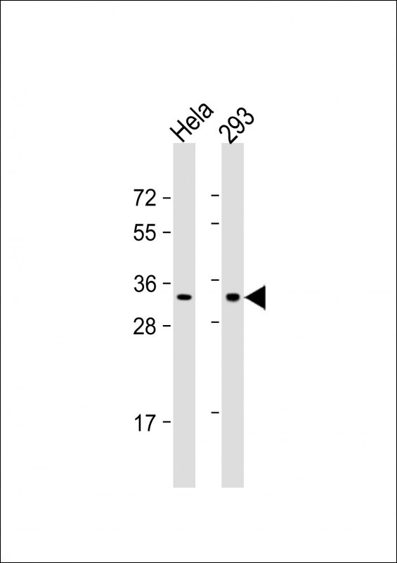 REA Antibody in Western Blot (WB)