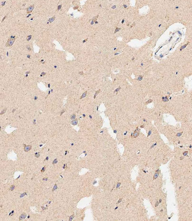 REA Antibody in Immunohistochemistry (Paraffin) (IHC (P))