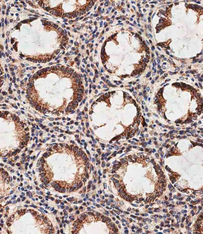 REA Antibody in Immunohistochemistry (Paraffin) (IHC (P))